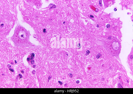 Tollwut-Virus, Negri Körper, LM Stockfoto