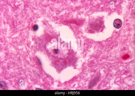 Tollwut-Virus, Negri Körper, LM Stockfoto