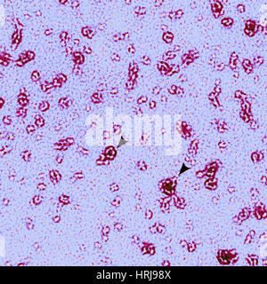 PmpD Protein, Chlamydia Trachomatis Bakterien, TEM Stockfoto