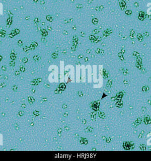 PmpD Protein, Chlamydia Trachomatis Bakterien, TEM Stockfoto