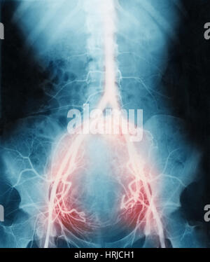 Normale Anatomie der Plazenta Stockfoto, Bild 7712859 Alamy