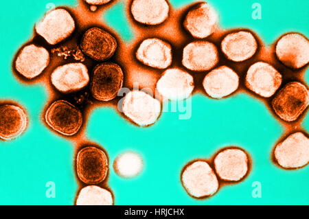 Vaccinia Virus ausgerottet Pocken, TEM Stockfoto