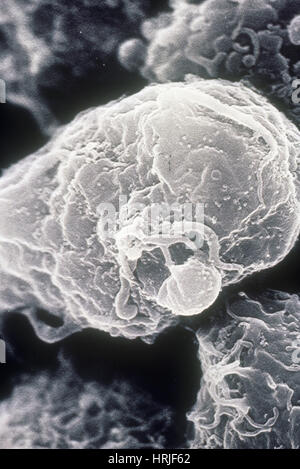 HIV-1 infizierten T4-Lymphozyten, SEM Stockfoto