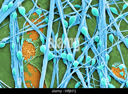 Neuronen und Gliazellen, SEM Stockfoto