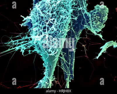 Ebola-Virus-Partikel, SEM Stockfoto