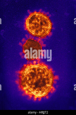 MERS-CoV, Betacoronavirus, TEM Stockfoto