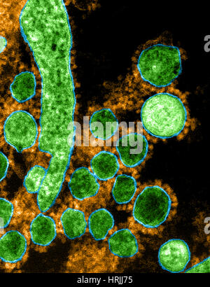 MERS-CoV, Betacoronavirus, TEM Stockfoto