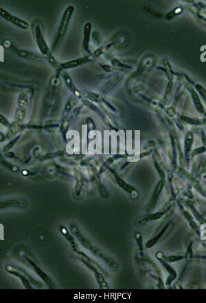 Milzbrand, Bacillus Anthracis Bakterien, LM Stockfoto