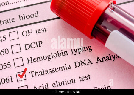 Rot markieren in screening-Formular-Anfrage für Thalassämie DNA test mit Blutprobe im Rohr. Stockfoto