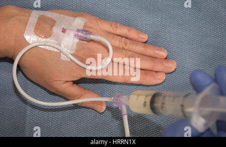 Nahaufnahme von einem Anästhesisten Injektion von Propofol, ein Beruhigungsmittel, in eine intravenöse in rechten des Patienten, die auf einem blauen OP-Tuch ist. Stockfoto