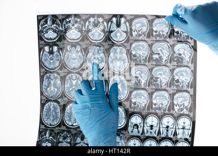 Teilansicht der Hände des Arztes in Schutzhandschuhen holding Röntgenbild Stockfoto