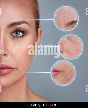 Porträt der Frau mit Zoomen Detail der Haut: Schaden, Akne, Falten Stockfoto