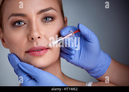 Frau, die Injektion von Botox in Lippen, Beauty-Behandlung Stockfoto