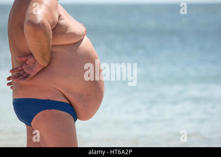 Seitenansicht der übergewichtige Mann. Übergewichtiger Mann im Freien. Schlechte Ernährung und Bewegungsmangel. Erhöhtes Risiko für Herzerkrankungen. Stockfoto