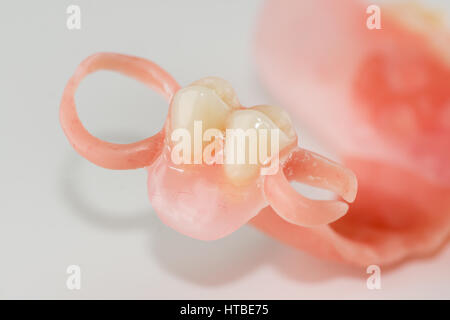 neue Nylon Prothese für einen Patienten mit einem teilweisen Verlust der Zähne Stockfoto