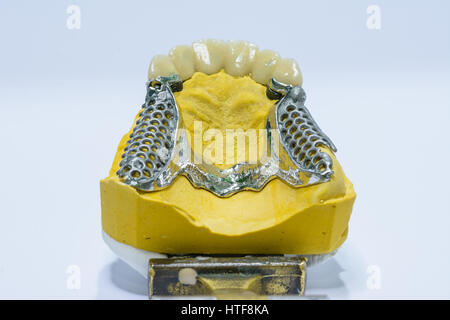 Skelett-Prothese Stockfoto