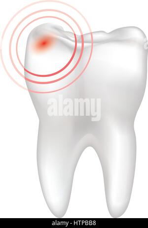 Zahn Schmerzen Zeichen isoliert. Zähne weiß unterzeichnen. Dental Medical Illustration. Stock Vektor