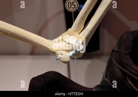 Das Modell zeigt einen menschlichen Ellbogen gemeinsame nach Tommy John Surgery,, National Baseball Hall Of Fame and Museum, Cooperstown, Vereinigte Staaten von Amerika. Stockfoto