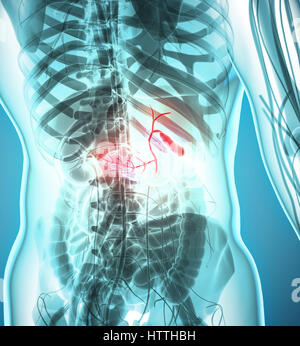 3D Darstellung der männlichen Gallenblase, Röntgen-medizinisches Konzept. Stockfoto