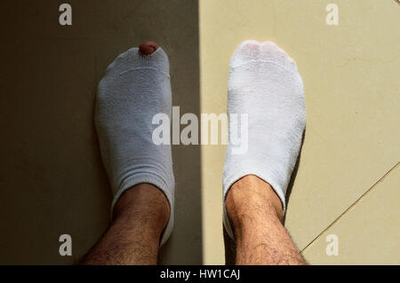 Linken Fuß mit einem Loch in der Socke und im Schatten, durch das Sonnenlicht des rechten Fußes getrennt. Stockfoto