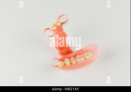 neue Nylon Prothese für einen Patienten mit einem teilweisen Verlust der Zähne Stockfoto
