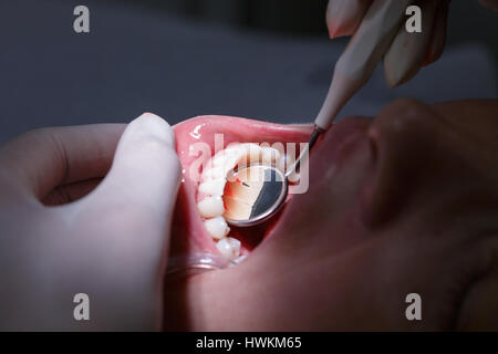 Patienten an Zahnärzte, bekommen ihren weißen Zähnen Interdentalräume mit Handspiegel für Zahnstein und Plaque untersucht. Dental-Hygiene, schmerzhafte p Stockfoto