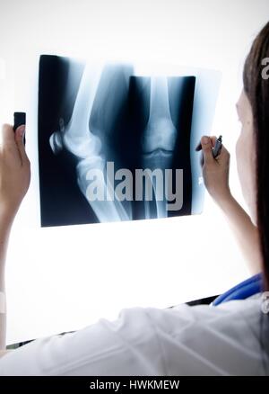Blick auf das x-ray Bild Knie im Krankenhaus Arzt Stockfoto