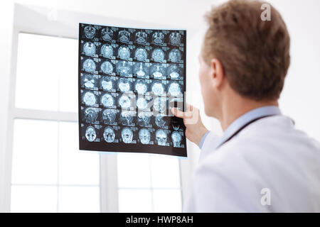 Besser zweimal zu überprüfen. Begangen von erfahrenen qualifizierten Arzt einen anderen Blick auf Patienten MRI Scans halten sie gegen helles Licht und lo Stockfoto