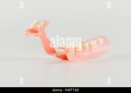 neue Nylon Prothese für einen Patienten mit einem teilweisen Verlust der Zähne Stockfoto
