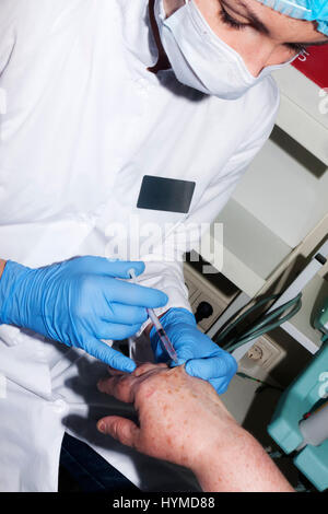 Mikrochirurgie: Hautarzt Chirurg führt Lokalanästhesie in der hand Stockfoto