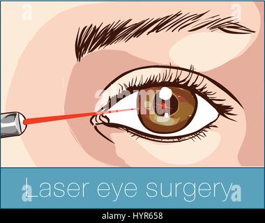 Nadel in einen Augapfel Symbol im Comic-stil auf weißem Hintergrund Stock Vektor