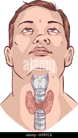 Vector Illustration eines Vektors Schilddrüse und Kehlkopf Stock Vektor