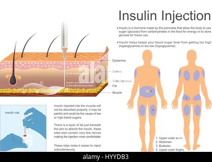 Insulin hilft verhindert, dass Ihr Blutzuckerspiegel immer zu hoch Hyperglykämie oder Hypoglykämie zu niedrig Stock Vektor