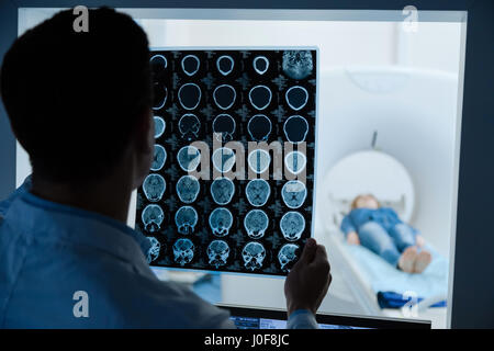 Professionellen männlichen Onkologe mit Blick auf die MRI Scan Bild Stockfoto