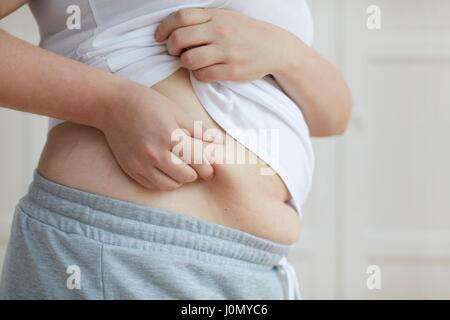 Frau mit Falten der Haut am Bauch. Stockfoto