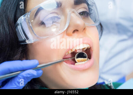 Zahnarzt nutzt Hohlspiegel. Patientin in Schutzbrille. Zahnärztliche Untersuchungsverfahren. Stockfoto