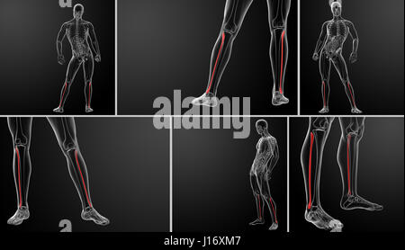 3D Rendering Außenillustration Fibuladefekt Stockfoto