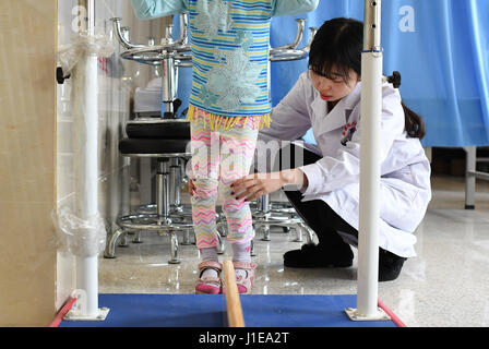 (170421)--URUMQI, 21. April 2017 (Xinhua)--Rehabilitation Therapeuten Min Xiaojuan (R) hilft eines der Zwillingsmädchen mit Bein Aufbautraining der sechs Affiliated Hospital von Xinjiang medizinischen Universität in Urumqi, der Hauptstadt von Nordwesten Chinas Xinjiang Uygur Autonome Region, 17. April 2017. Die sechs-jährigen Zwillinge aus Usbekistan der infantilen Zerebralparese diagnostiziert, als sie im November 2016 nach China kam, können nicht beide laufen unabhängig und klar auszudrücken. Nach der Behandlung mit Akupunktur, therapeutische Massage, Kräutermedizin und Rehabilitationstherapie, konnten die Zwillinge Indep gehen. Stockfoto