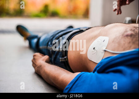 ein Mädchen hilft einen Kerl nach dem Herzinfarkt mit Reanimation Stockfoto