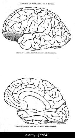 Autopsie-Zeichnungen des Gehirns von Leon Czolgosz Stockfoto
