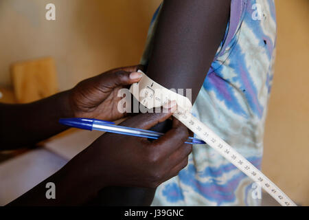 Kiryangondo Flüchtlingslager. Unterernährung Präventionsprogramm von Besorgnis weltweit geführt. Stockfoto