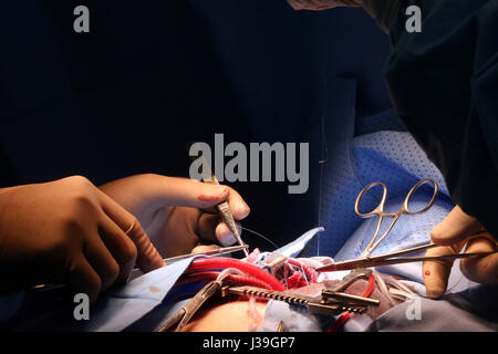 OP-Saal. Herzchirurgie. Stockfoto