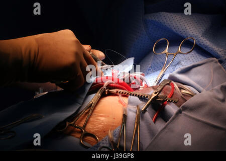 OP-Saal. Herzchirurgie. Stockfoto