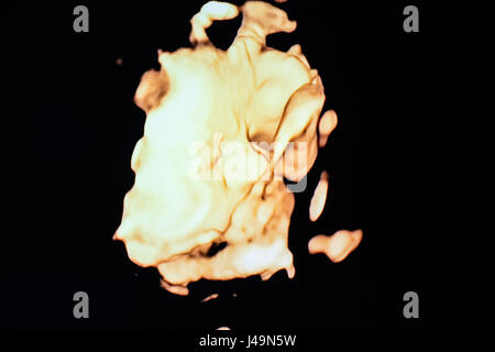 neonatale Ultraschall Stockfoto