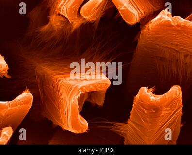 Nanodrähte auf Vanadium Oxid. Farbige scanning Electron Schliffbild (SEM) von Nanodrähten gebildet auf einer Vanadium Oxid-Oberfläche, die durch Erhitzen mit einem Laserstrahl geschmolzen wurde. Diese Forschung beinhaltet die Verwendung von Lasern, Ätzen und abtragen, Metall- und semicond Stockfoto