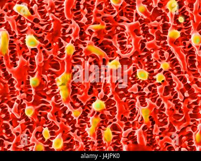 Nanostrukturen auf Nickel. Farbige scanning Electron Schliffbild (SEM) von Nanostrukturen auf eine Nickel-Oberfläche durch ultrakurze Pulse eines Laserstrahls gebildet. Diese Forschung beinhaltet die Verwendung von Lasern, Ätzen und Abtragen von Metall und Halbleiter Oberflächen. Das Urlaubsland Stockfoto