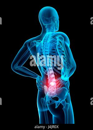 Menschliche Wirbelsäule und Rückenschmerzen, Abbildung. Stockfoto