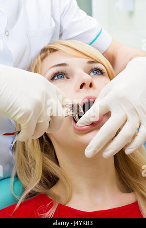 Closeup junge Frau am Zahnarztpraxis Klinik. Männlichen Arzt und Assistentin Extraktionsverfahren mit Pinzette entfernen Patienten Zahn durchführen. Healthcar Stockfoto