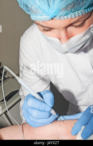 Hautarzt Chirurg entfernt Hautkrankheiten mit Elektrokoagulator Stockfoto