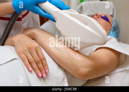 Hardware-Kosmetik. Epilation. ELOS Haarentfernung. Der Mensch ist nicht wiederzuerkennen. Schöne weibliche Hände. Stockfoto